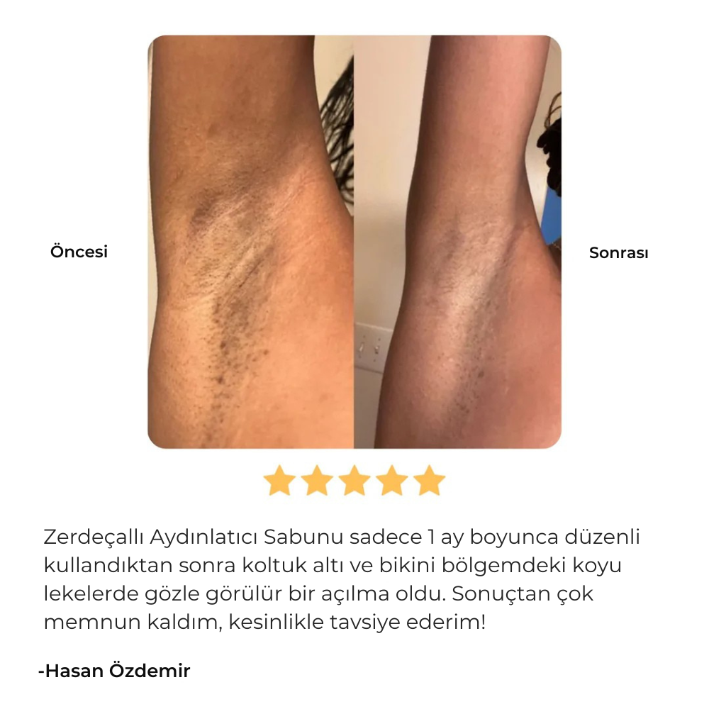 zabun® limon, zerdeçal ve kojik asitli aydınlatıcı sabun