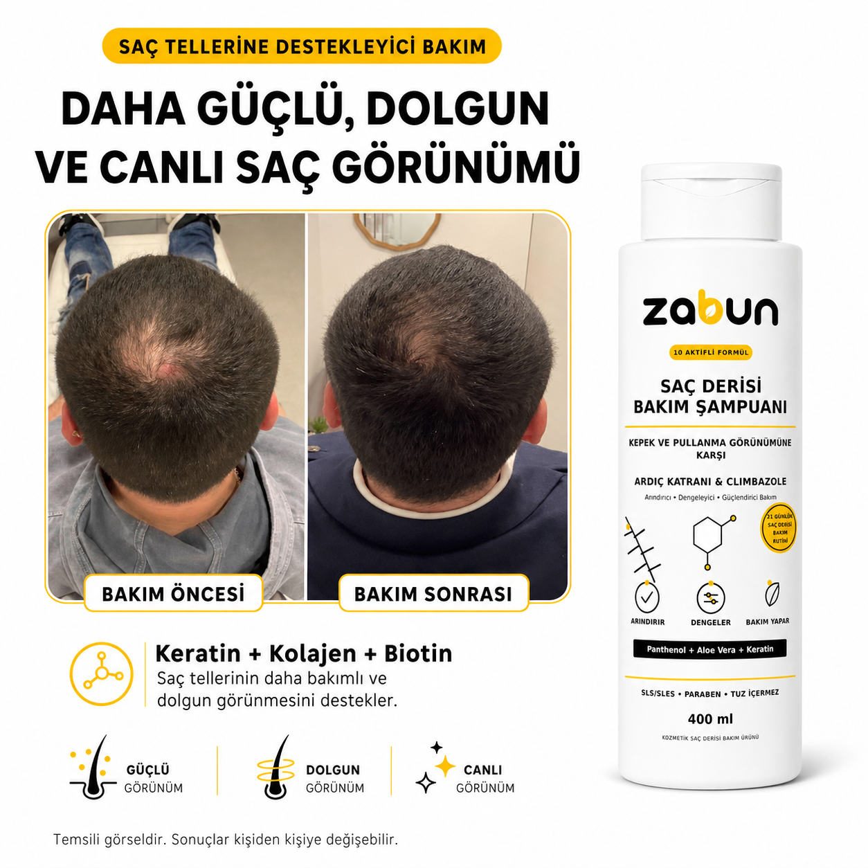Zabun Ardıç Katranlı Kepek Karşıtı Saç Derisi Bakım Şampuanı – Climbazole, 400 ml